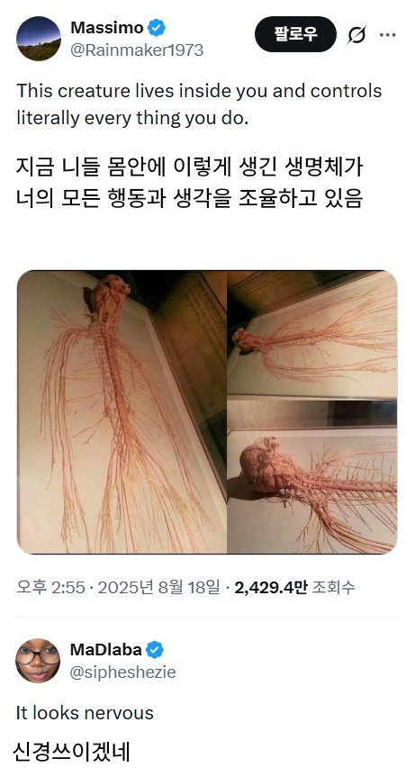 몸에 기생하는. 거대한 생명체.jpg